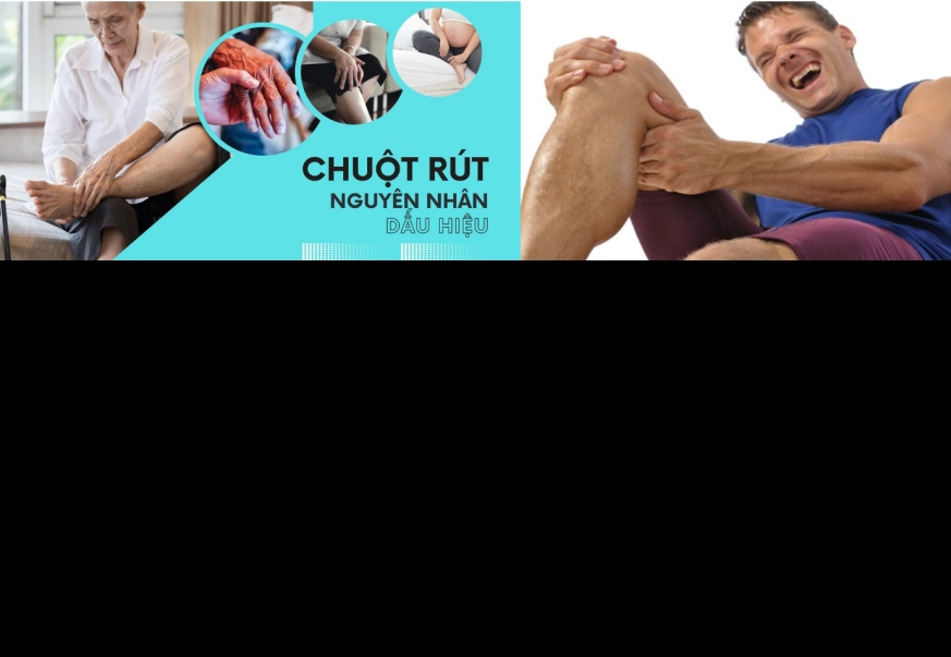 Bệnh chuột rút (hay miền Nam được gọi là vọp bẻ) đã trở thành một căn bệnh phổ biến mà ai cũng có thể là người mắc phải. 